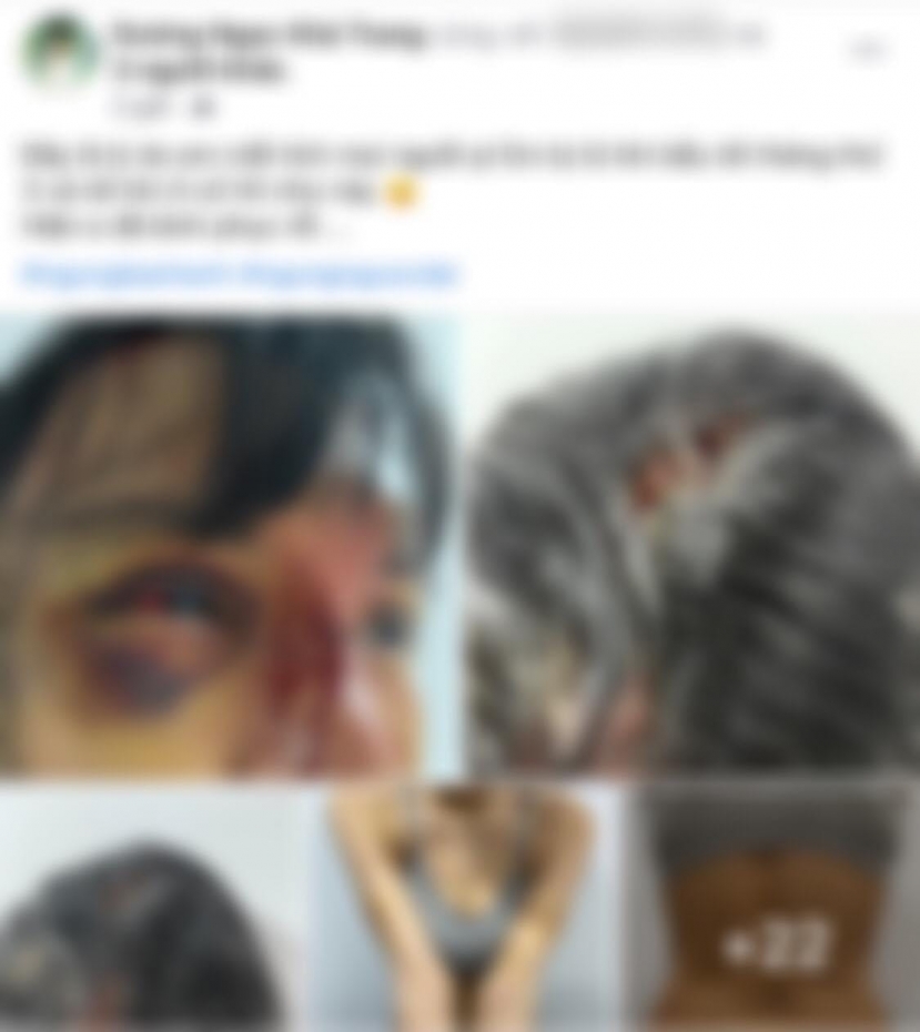 Mạng xã hội xôn xao trước bài viết tố bị người khác bạo hành của siêu mẫu Khả Trang Mạng xã hội xôn xao trước bài viết tố bị người khác bạo hành của siêu mẫu Khả Trang