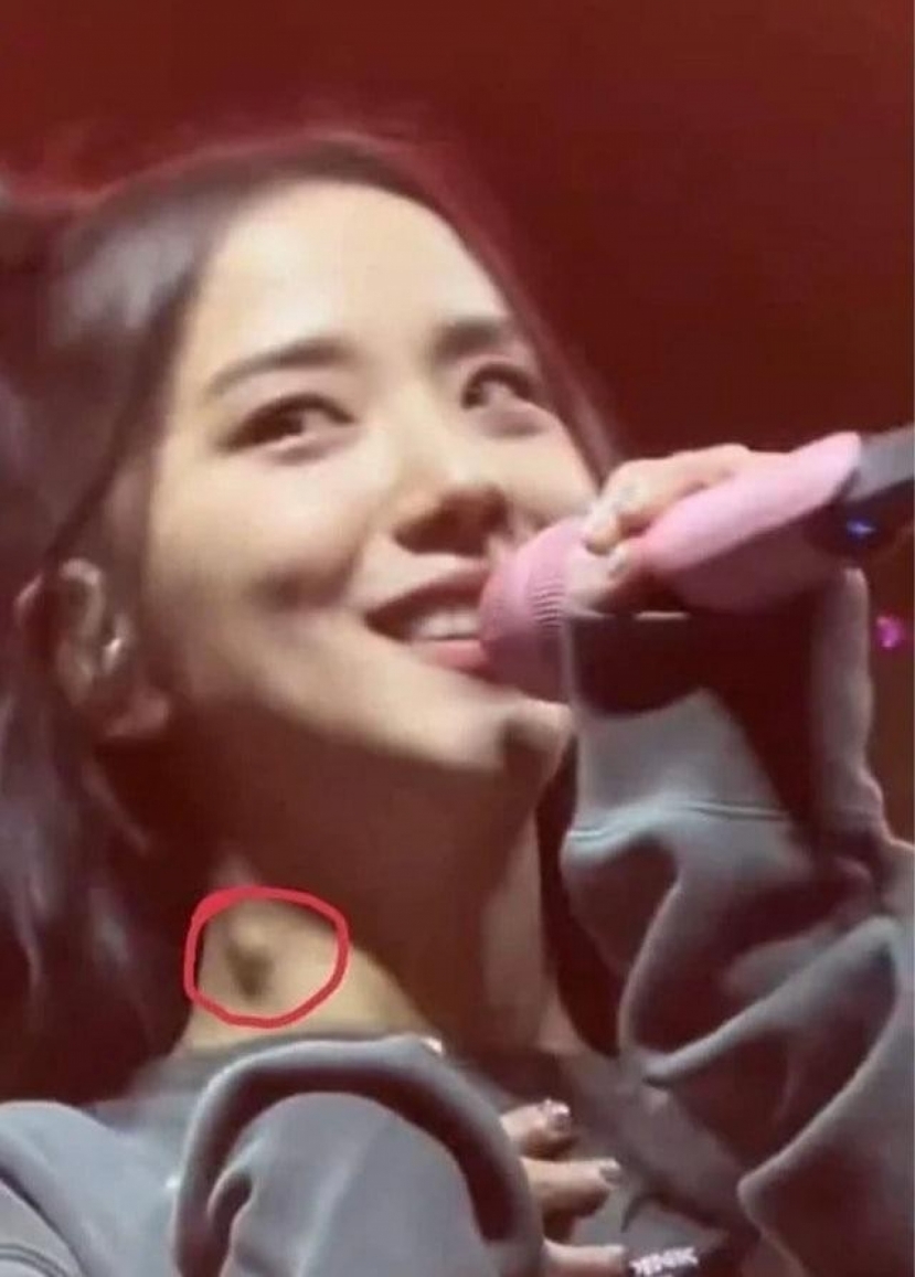 Tình trạng của Jisoo khiến người hâm mộ lo lắng. Ảnh HK01 Tình trạng của Jisoo khiến người hâm mộ lo lắng. Ảnh HK01
