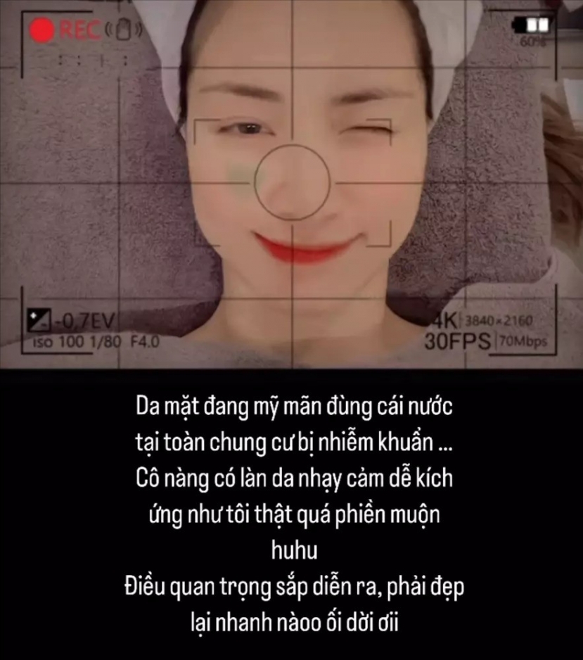 Hòa Minzy tiết lộ muộn phiền với làn da. Ảnh FBNV Hòa Minzy tiết lộ muộn phiền với làn da. Ảnh FBNV