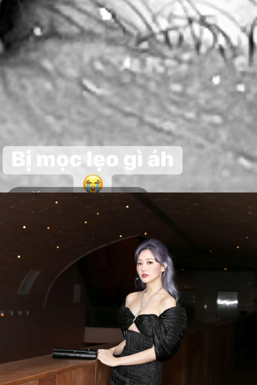 Hari Won tiếp tục gây lo lắng khi chia sẻ lên trang cá nhân vấn đề sức khỏe đang gặp phải Hari Won tiếp tục gây lo lắng khi chia sẻ lên trang cá nhân vấn đề sức khỏe đang gặp phải