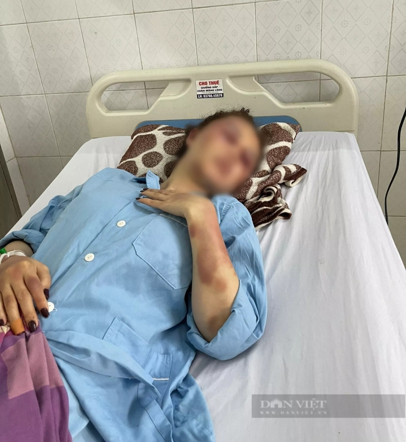 Công an vào cuộc điều tra vụ người phụ nữ tố bị cán bộ Cục Quản lý thị trường hành hung dã man Công an vào cuộc điều tra vụ người phụ nữ tố bị cán bộ Cục Quản lý thị trường hành hung dã man