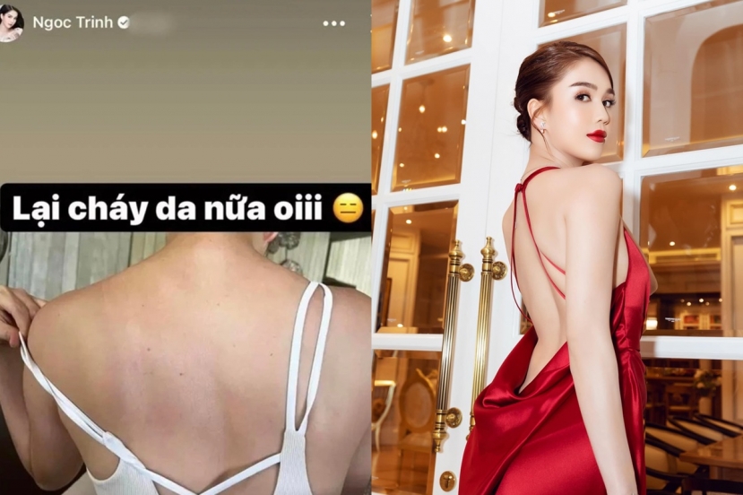 Ngọc Trinh 'lá ó' vì tấm lưng bị cháy nắng, cùng với đó là nhiều nốt sần, nguy cơ bị xóa sổ danh hiệu nữ hoàng nội y Ngọc Trinh 'lá ó' vì tấm lưng bị cháy nắng, cùng với đó là nhiều nốt sần, nguy cơ bị xóa sổ danh hiệu nữ hoàng nội y