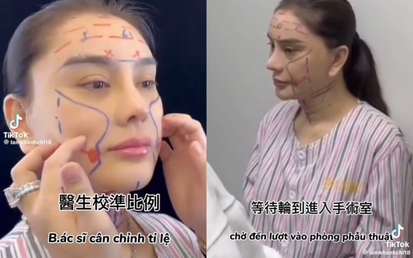 Lâm Khánh Chi kể tường tận công cuộc trùng tu gương mặt, dân tình vừa thương vừa sợ Lâm Khánh Chi kể tường tận công cuộc trùng tu gương mặt, dân tình vừa thương vừa sợ